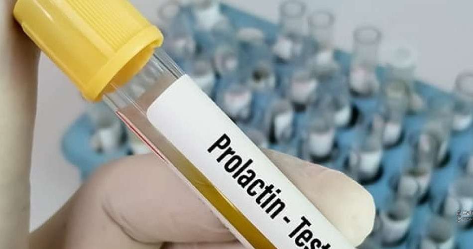 prolaktin-hormonu-nedir-ne-ise-yararjpg-1300x500