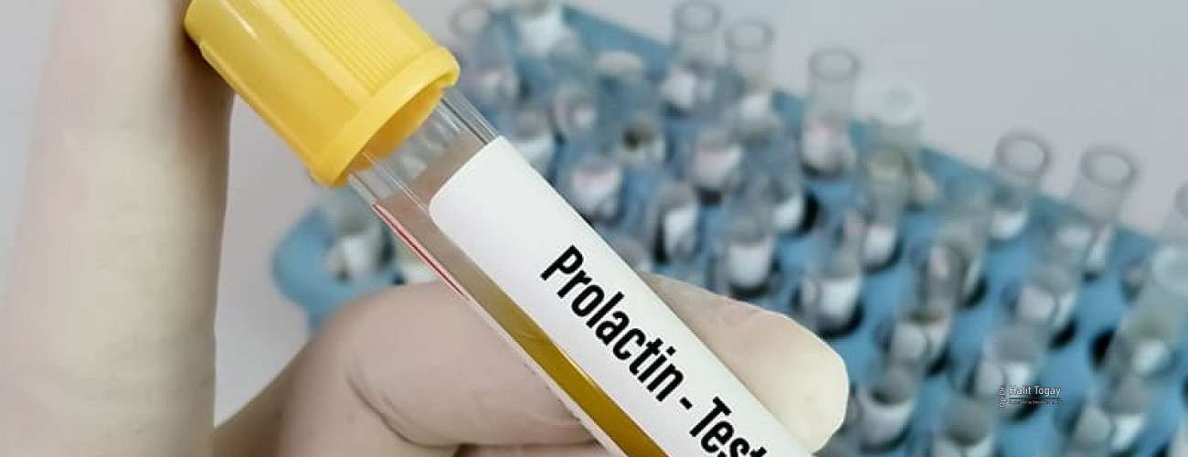 prolaktin-hormonu-nedir-ne-ise-yararjpg-1300x500