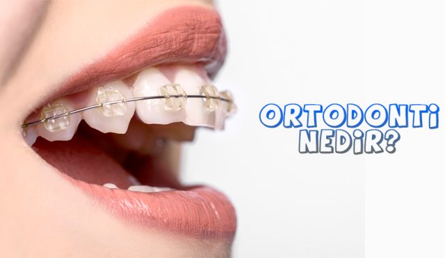 Ortodonti Nedir?
