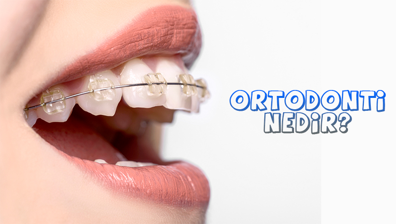 ortodonti-nedir